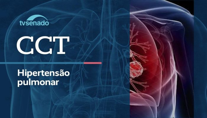 Debate Sobre Hipertensão Pulmonar Marca CCT